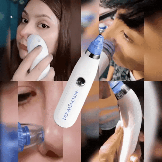 UP Aspiradora Facial Derma Suave